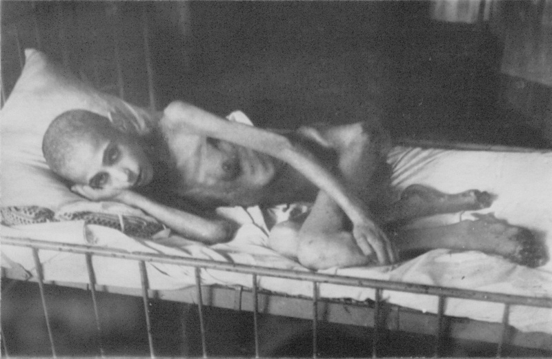 A dystrophic woman in Leningrad, 1942